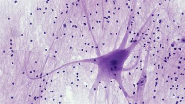 Adaptogens for Stress and Athletic Performance